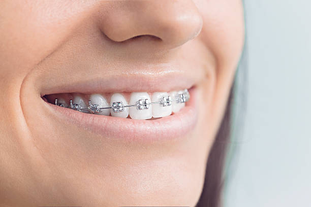 Best Invisalign and Clear Aligners  in Carencro, LA
